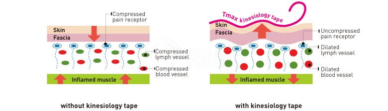 Tmax kinesiologitape 5m x 5cm – Hudvenlig og vandafvisende